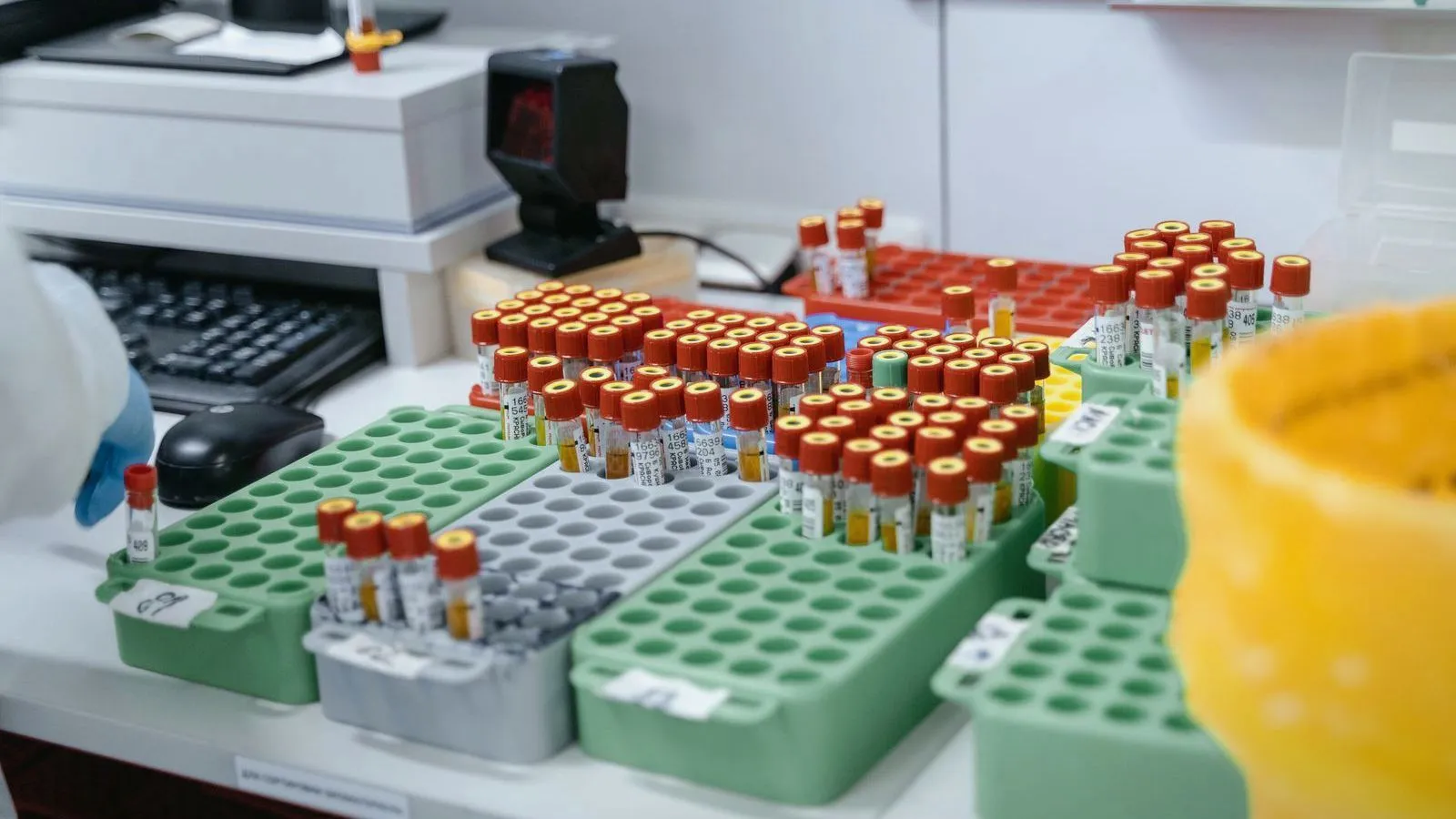 Racks of blood sample tubes on a laboratory bench beside a computer