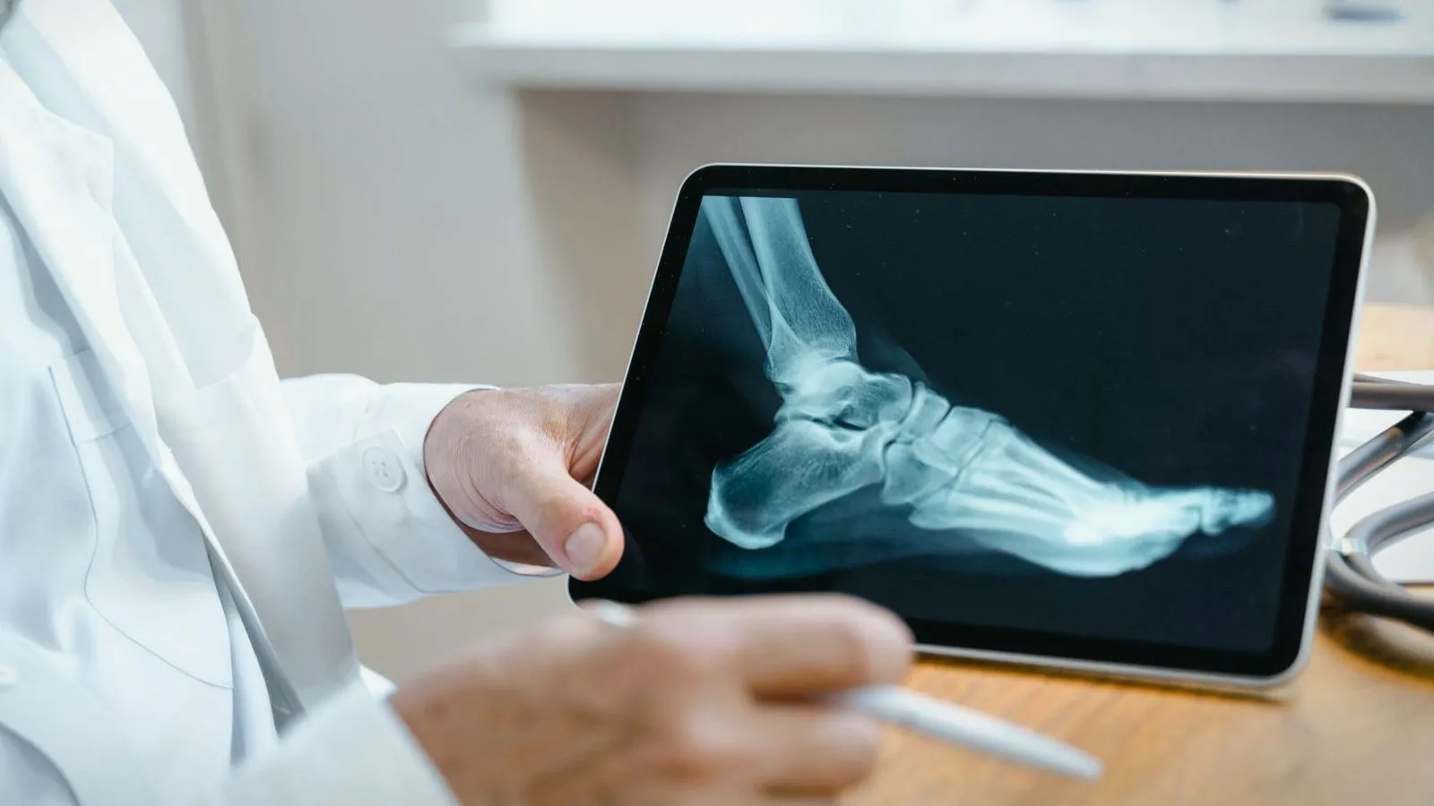 A clinician in a white coat holds a tablet showing a side-view X-ray of a foot and points at it with a stylus.