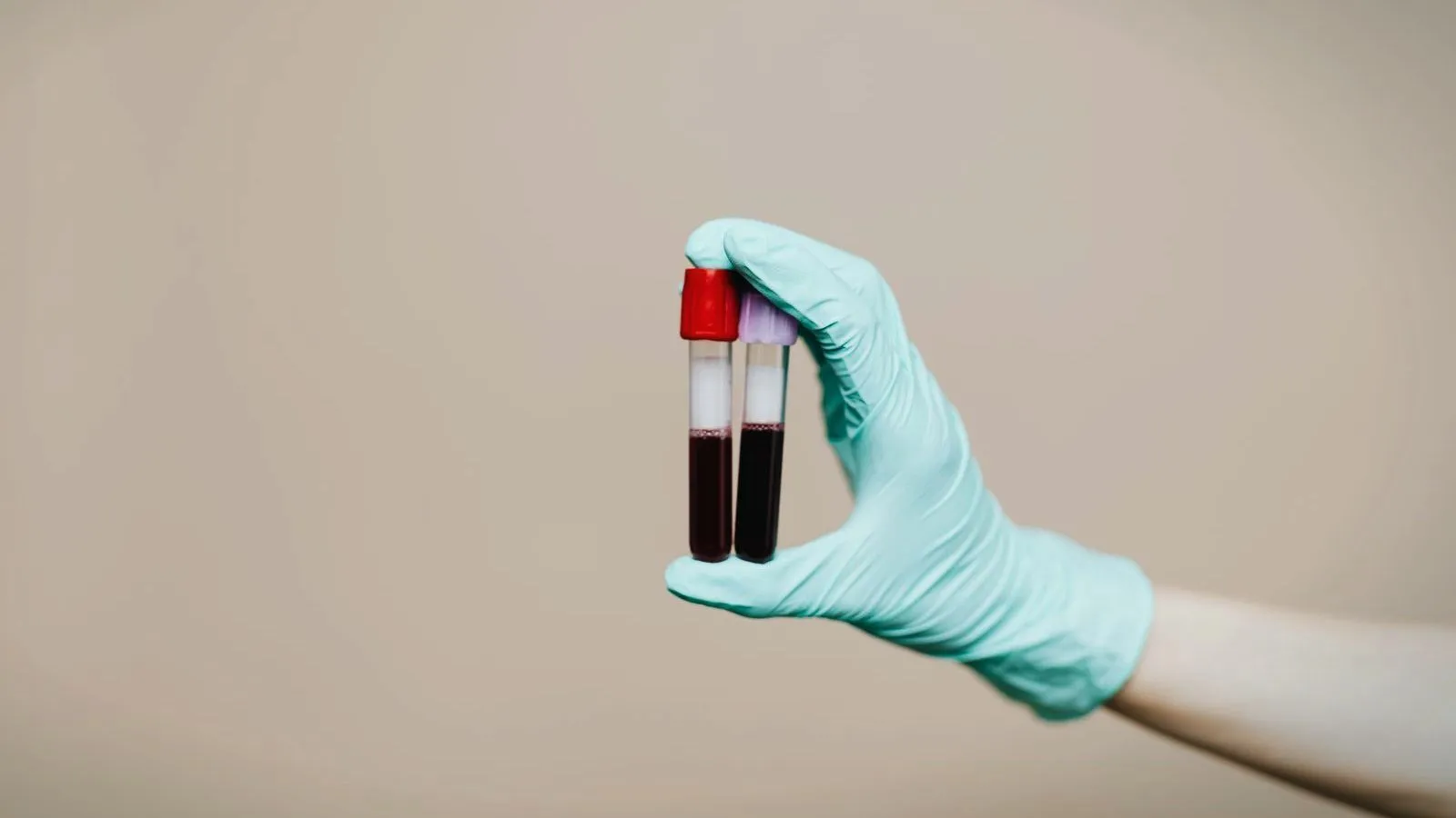 A gloved hand holding two tubes of blood against a beige background