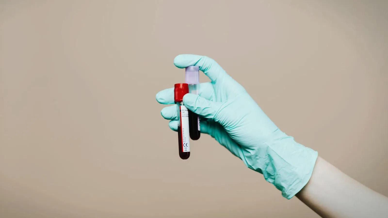 A gloved hand holding two tubes of blood against a plain beige background.