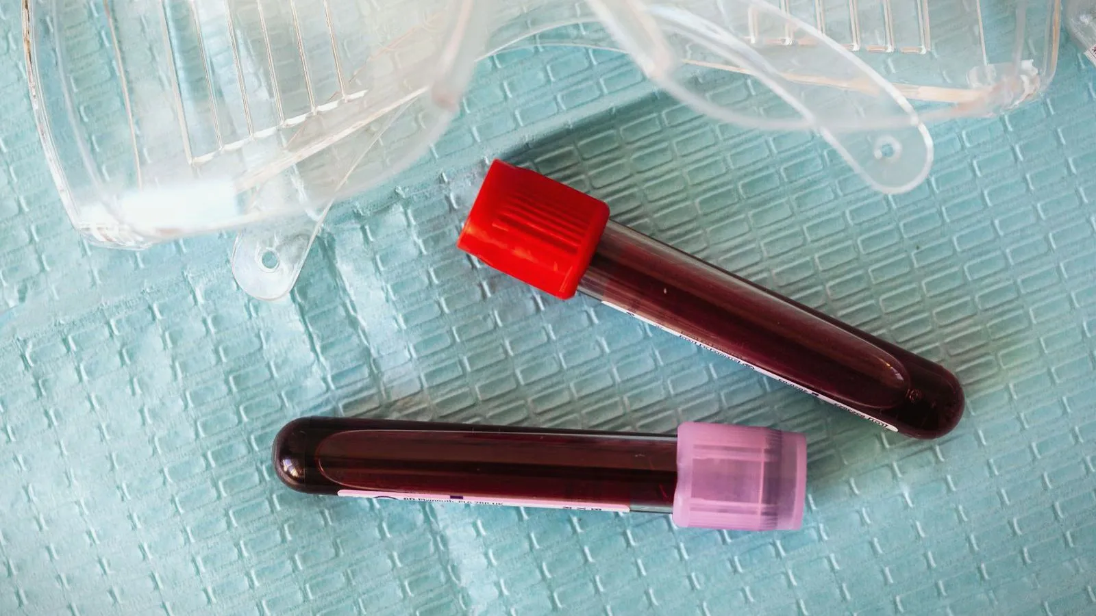 Two filled blood collection tubes, one red-capped and one lavender-capped, beside safety goggles on a blue drape