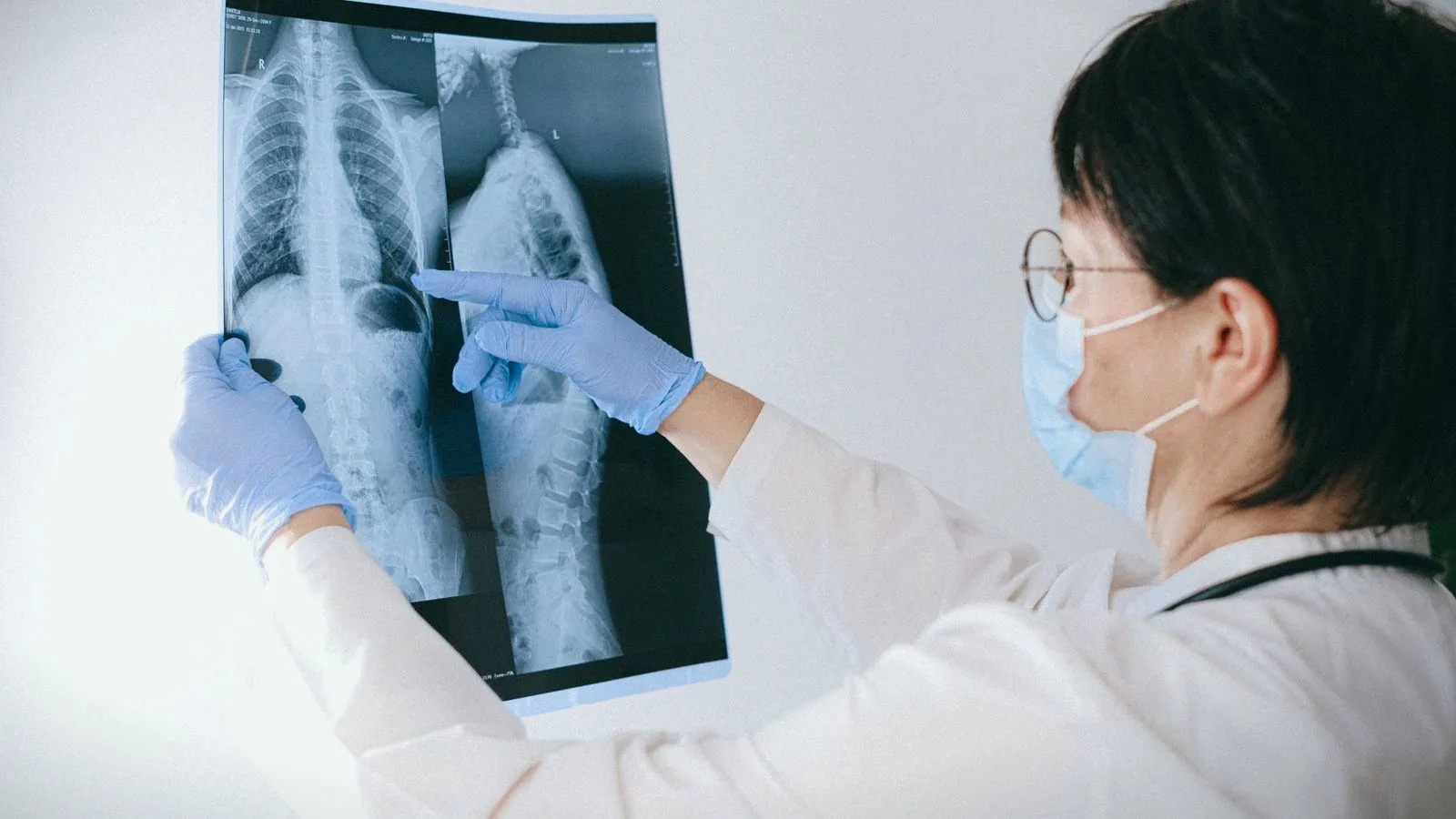 A clinician pointing at a chest X-ray held up to the light