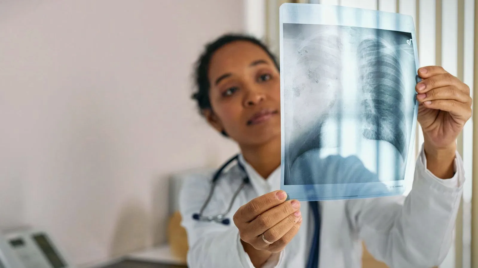 A clinician holding a chest x-ray film up to the light