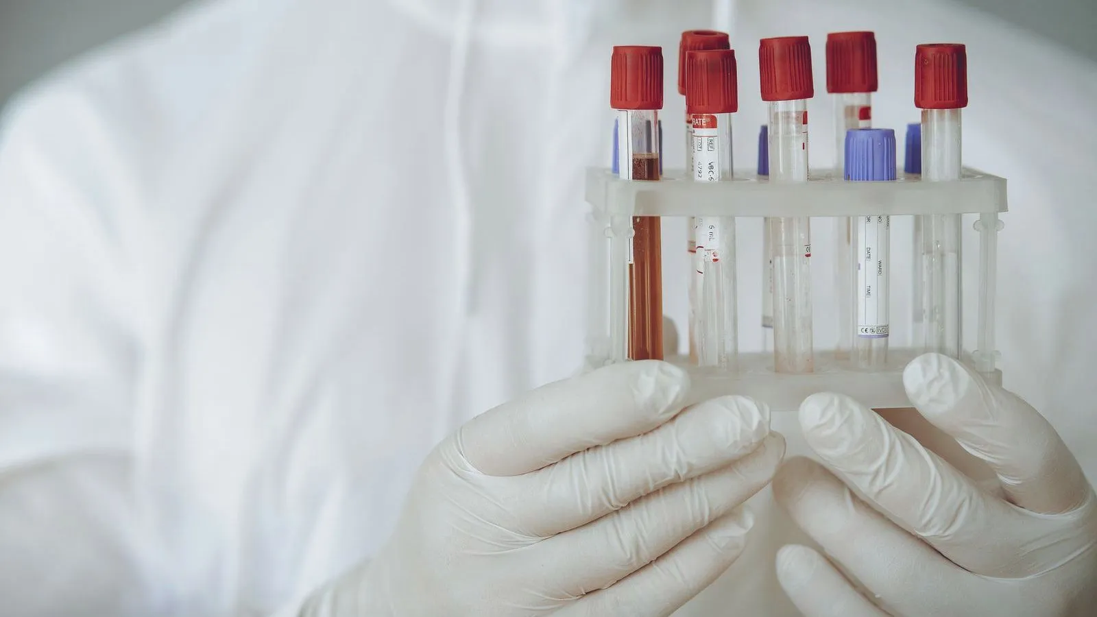 Gloved hands holding a rack of blood sample tubes with red and purple caps