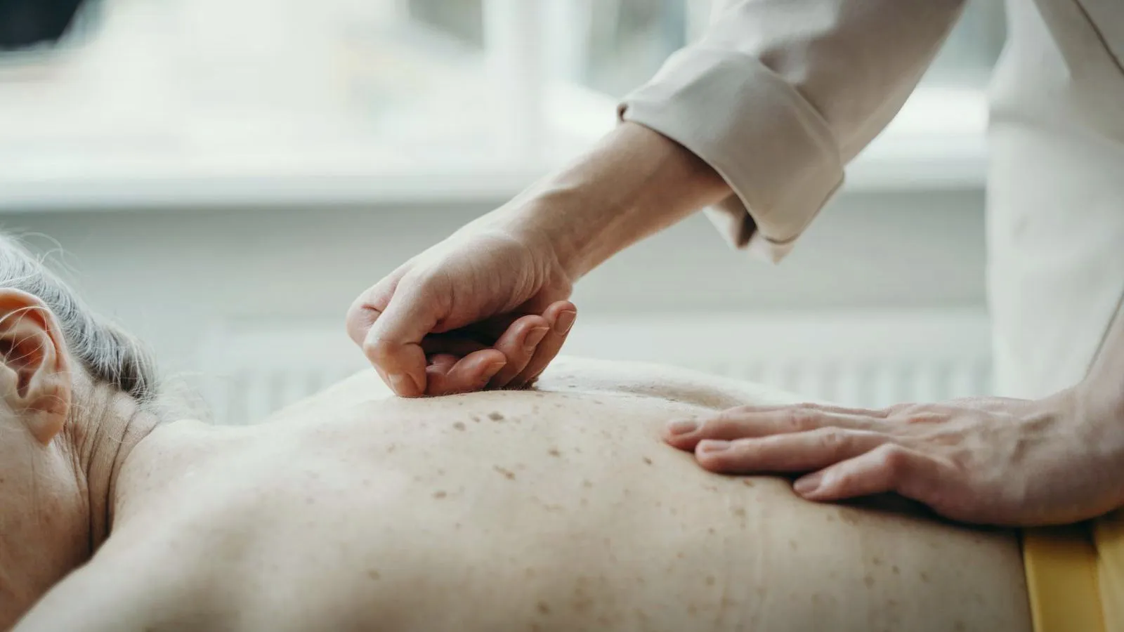 A clinician examining moles on the back of an older patient