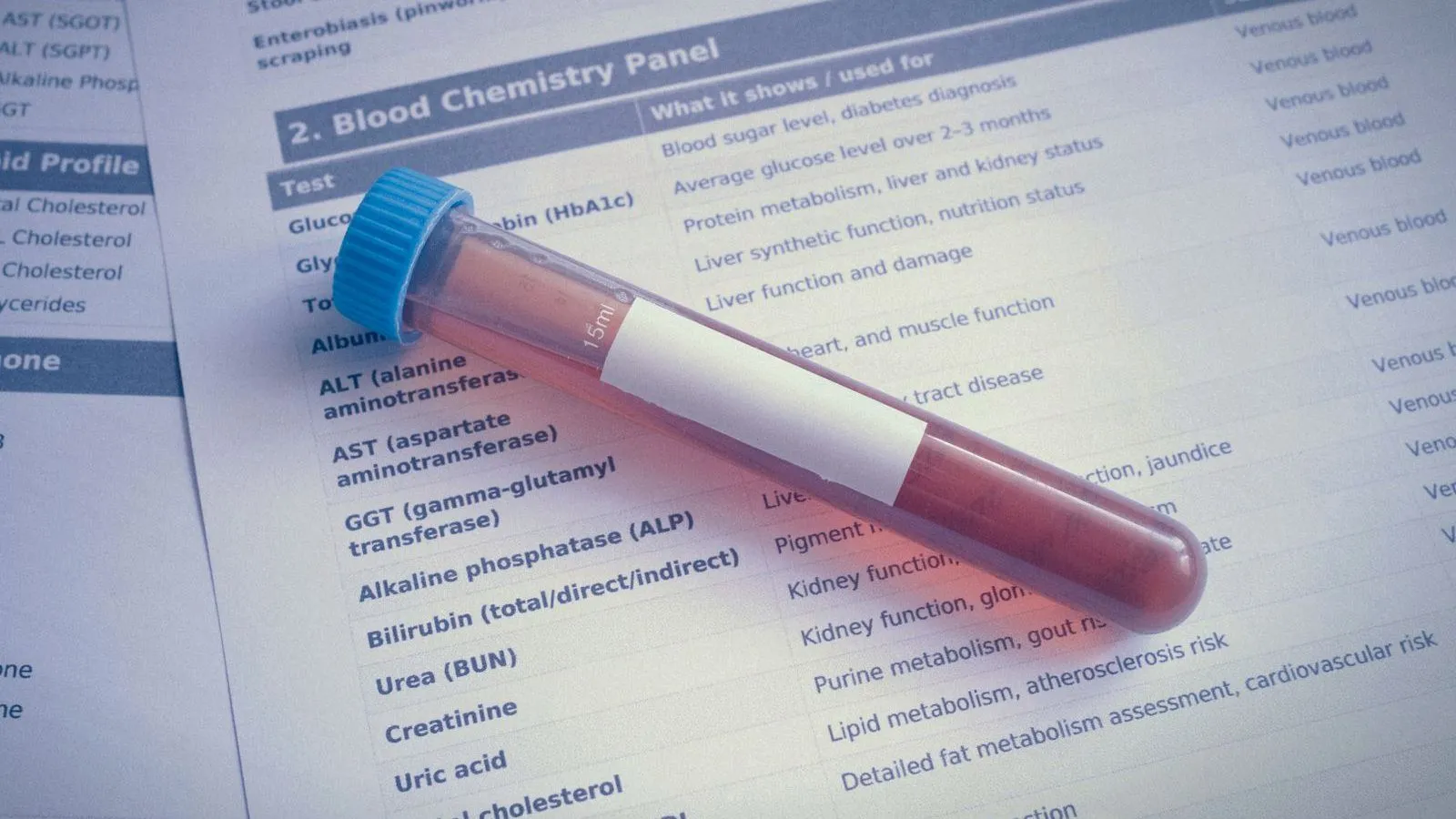 A capped blood sample tube with a blank label lies on a printed blood chemistry panel listing lab tests.