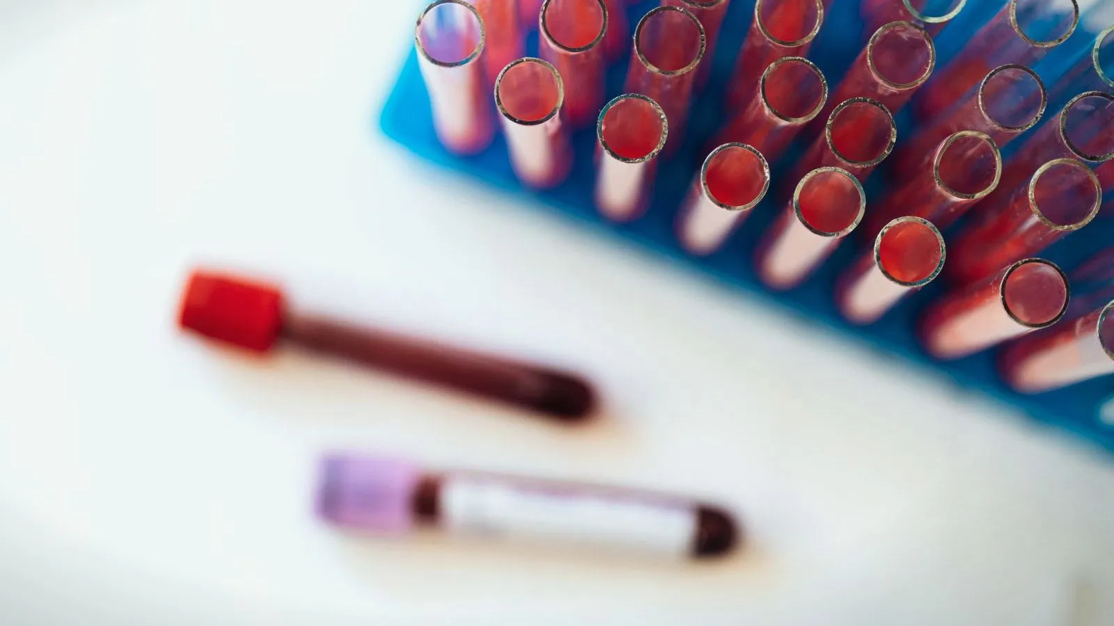 Blood sample tubes lying beside a rack of tubes.