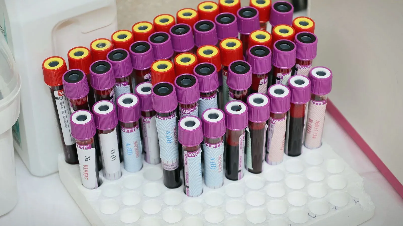 A dense rack of capped blood collection tubes in a laboratory