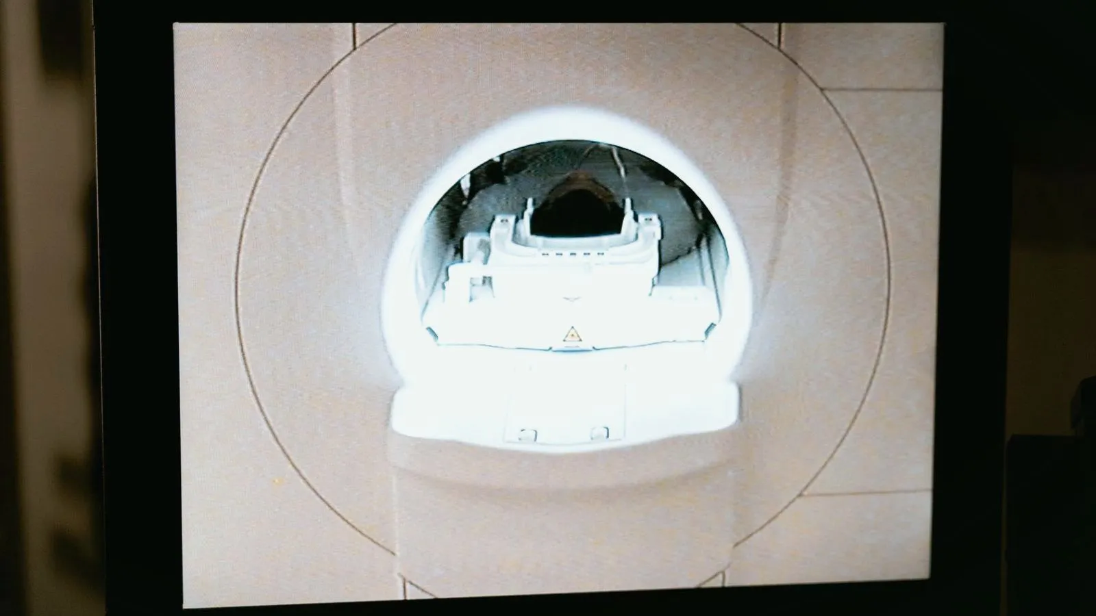An MRI scanner's circular opening shown on a monitor screen