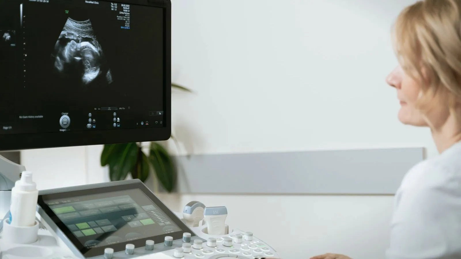 An ultrasound scan on a monitor beside a clinician and a patient