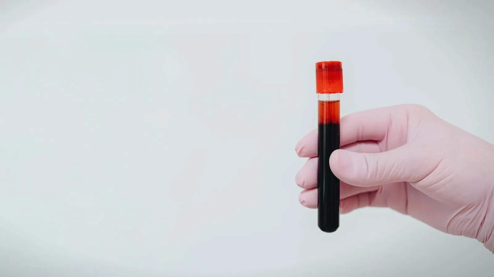 A hand in a pink glove holds a tube of dark blood with a red cap against a plain pale background.