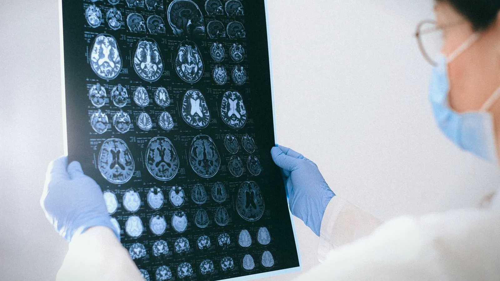 A clinician in gloves holding a sheet of brain scan slices to the light