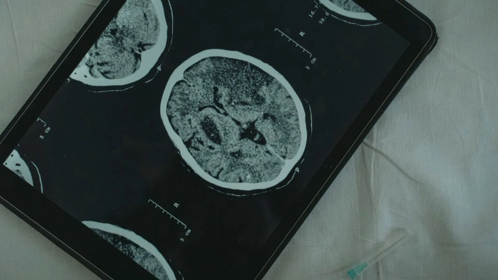 Brain scan slices displayed on a tablet resting on a bed